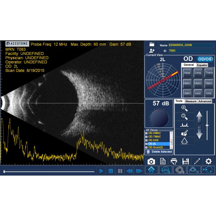 Keeler Ophthalmic Instruments - 4Sight Ultrasound Platform