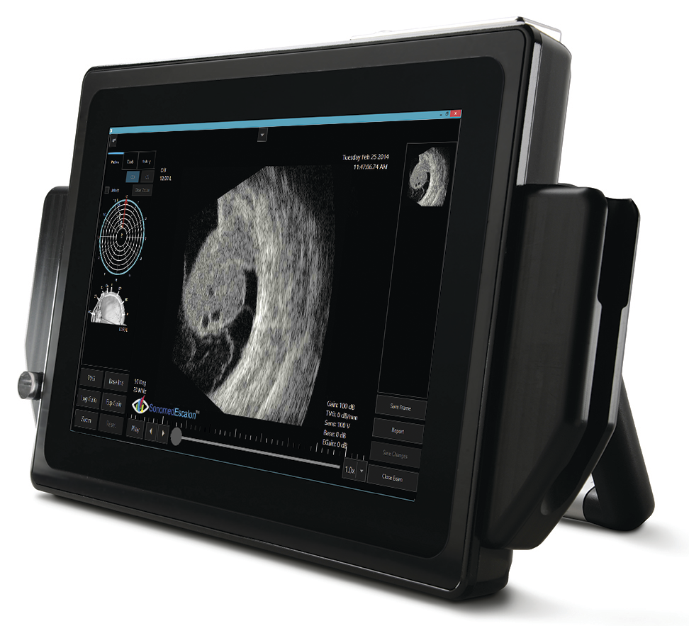 Ophthalmic Equipment | Sonomed VuPad Portable B-Scan Ultrasound ...